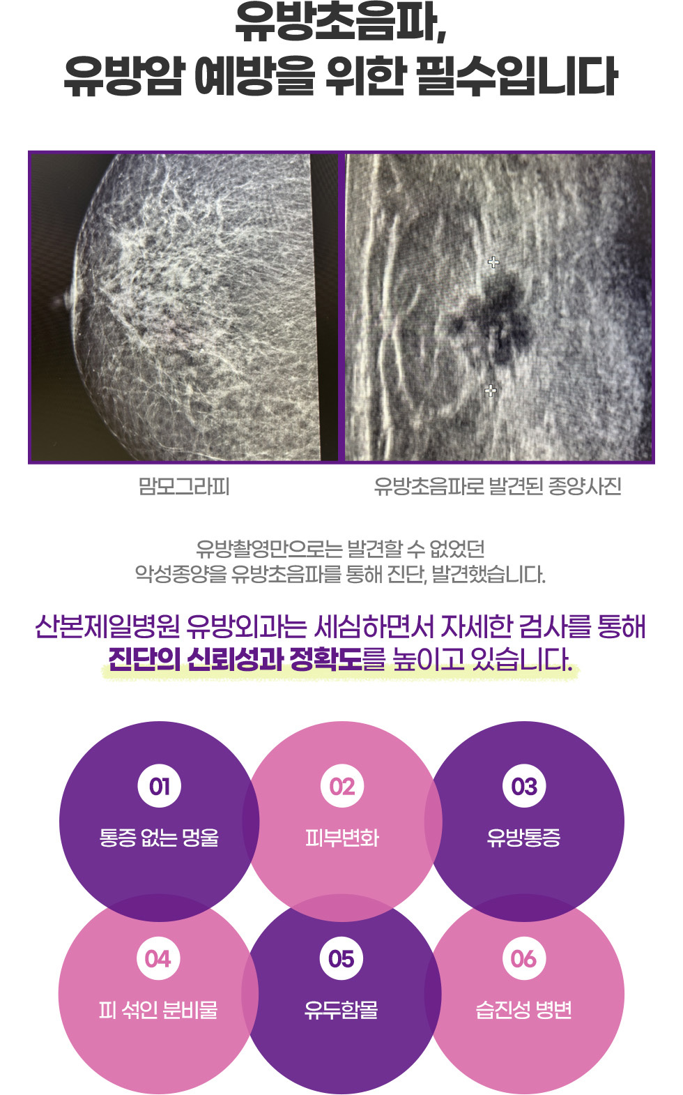 유방초음파, 유방암 예방을 위한 필수입니다.